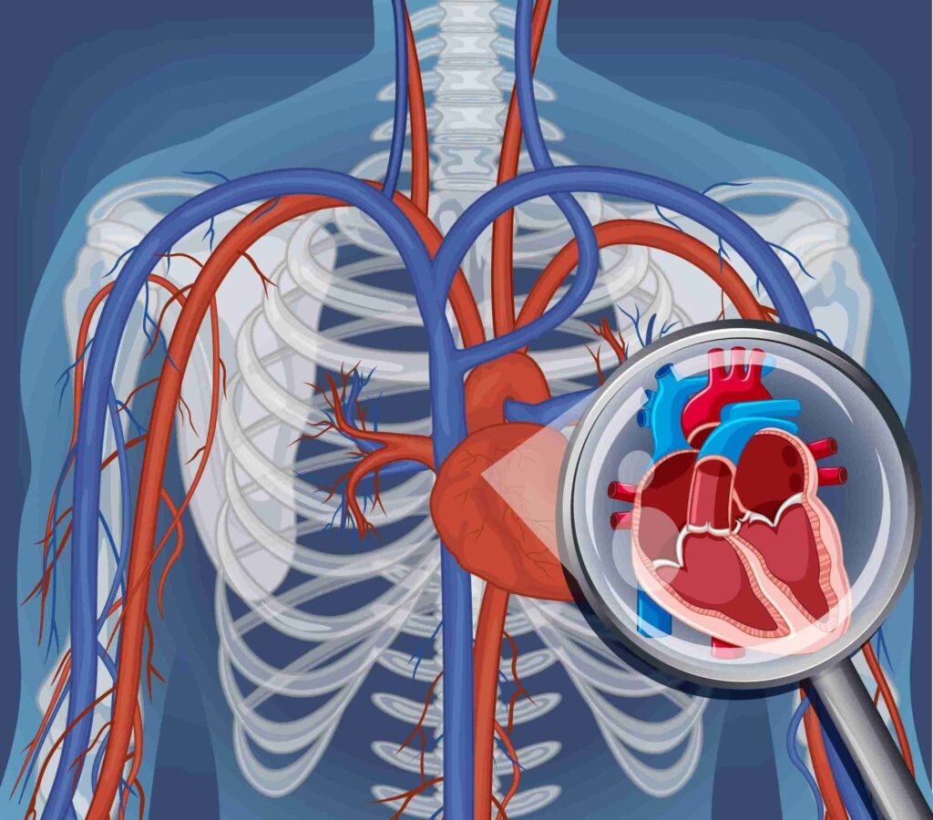 Aortic Aneurysm and Dissection