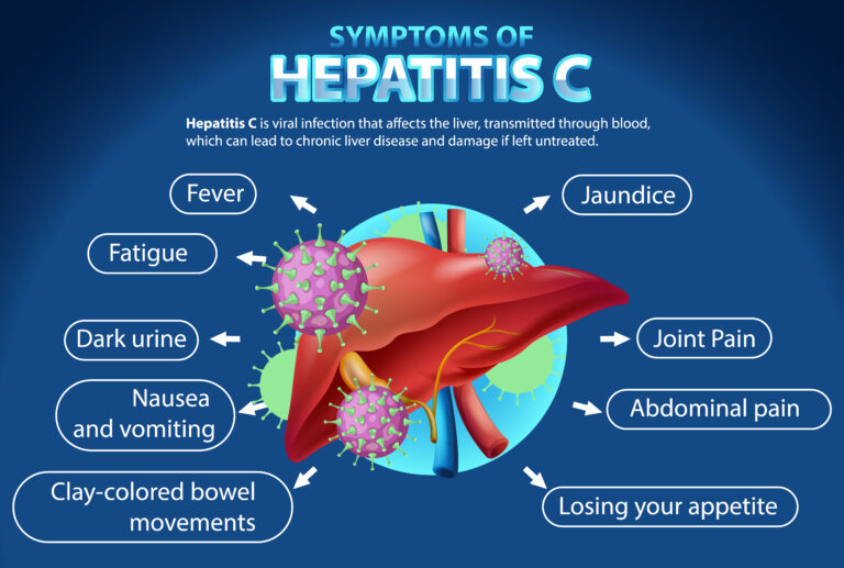 hepatitis C